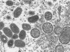 【蜗牛棋牌】韩国将猴痘列为乙类传染病 感染者需隔离