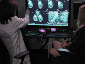 【蜗牛棋牌】研究称谷歌AI诊断乳腺癌比医生还准 要取代还尚早