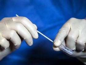 【蜗牛棋牌】西班牙已开始实施肛拭子新冠病毒检测方式