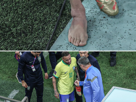 【蜗牛棋牌】外媒：因脚踝伤势，内马尔缺席对阵瑞士队小组赛