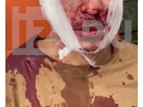 【蜗牛棋牌】俄媒:莫斯科州恐袭事件一嫌疑人受审视频公开,称在去布良斯克路上扔掉了武器