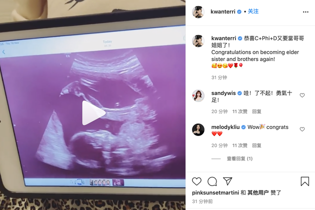 恭喜！关颖宣布怀第四胎 晒宝宝超声波照片萌化了