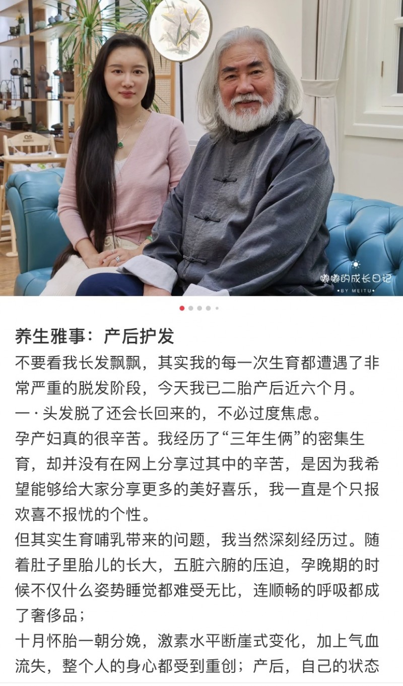 张纪中娇妻首谈怀孕经历 自曝脱发严重睡眠难