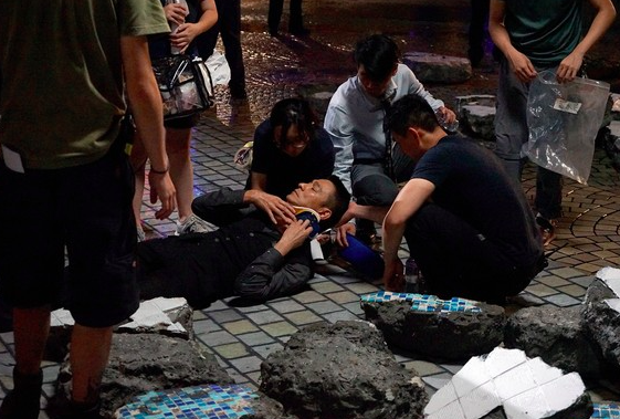 刘德华被曝拍《拆弹专家2》受伤 手指遭割2cm口子