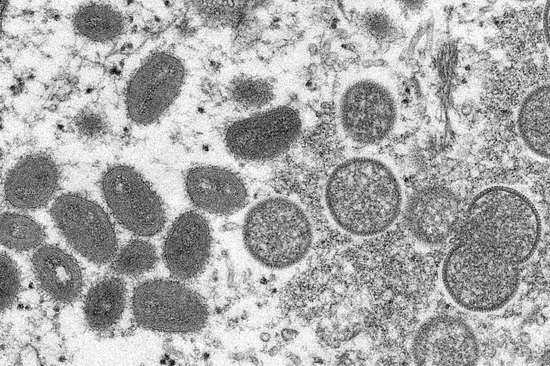 【蜗牛棋牌】韩国将猴痘列为乙类传染病 感染者需隔离