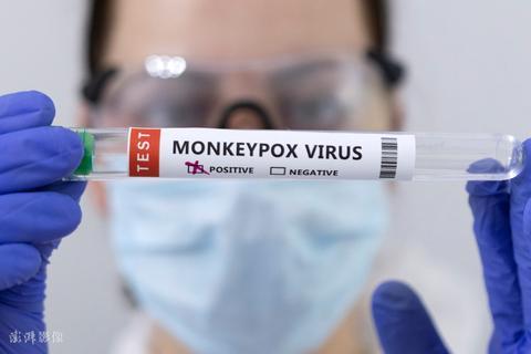 美国两名儿童感染猴痘病毒 系家庭传播