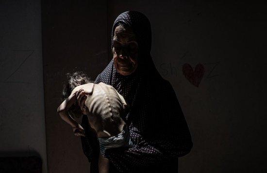 特写｜饥饿围城：加沙的生死挣扎